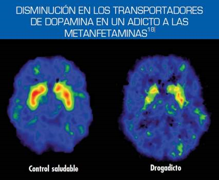 Tomado de NIDA (Noviembre 2014): Las drogas y el cerebro