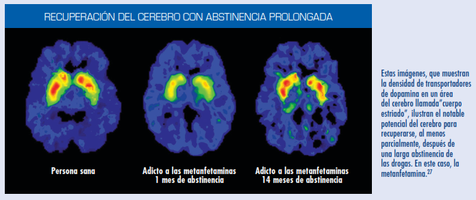 Tomado de NIDA (Noviembre 2014): Las drogas y el cerebro